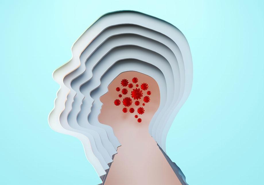 Un fil conducteur des deux nouvelles études allemandes est la persistance de la neuroinflammation, avec des résultats histologiques ou d'imagerie présents des mois après la maladie COVID-19 (Getty Images)