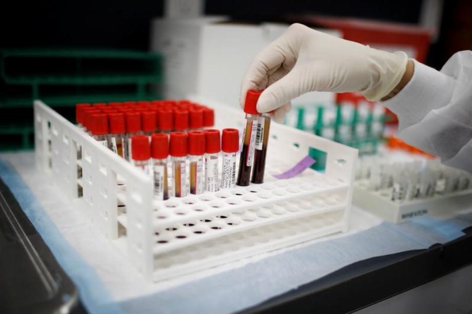 Les chercheurs ont examiné des échantillons de sang de base de 2 540 participants pour les niveaux d'antigène SARS-CoV-2. (REUTERS/Marco Bello)