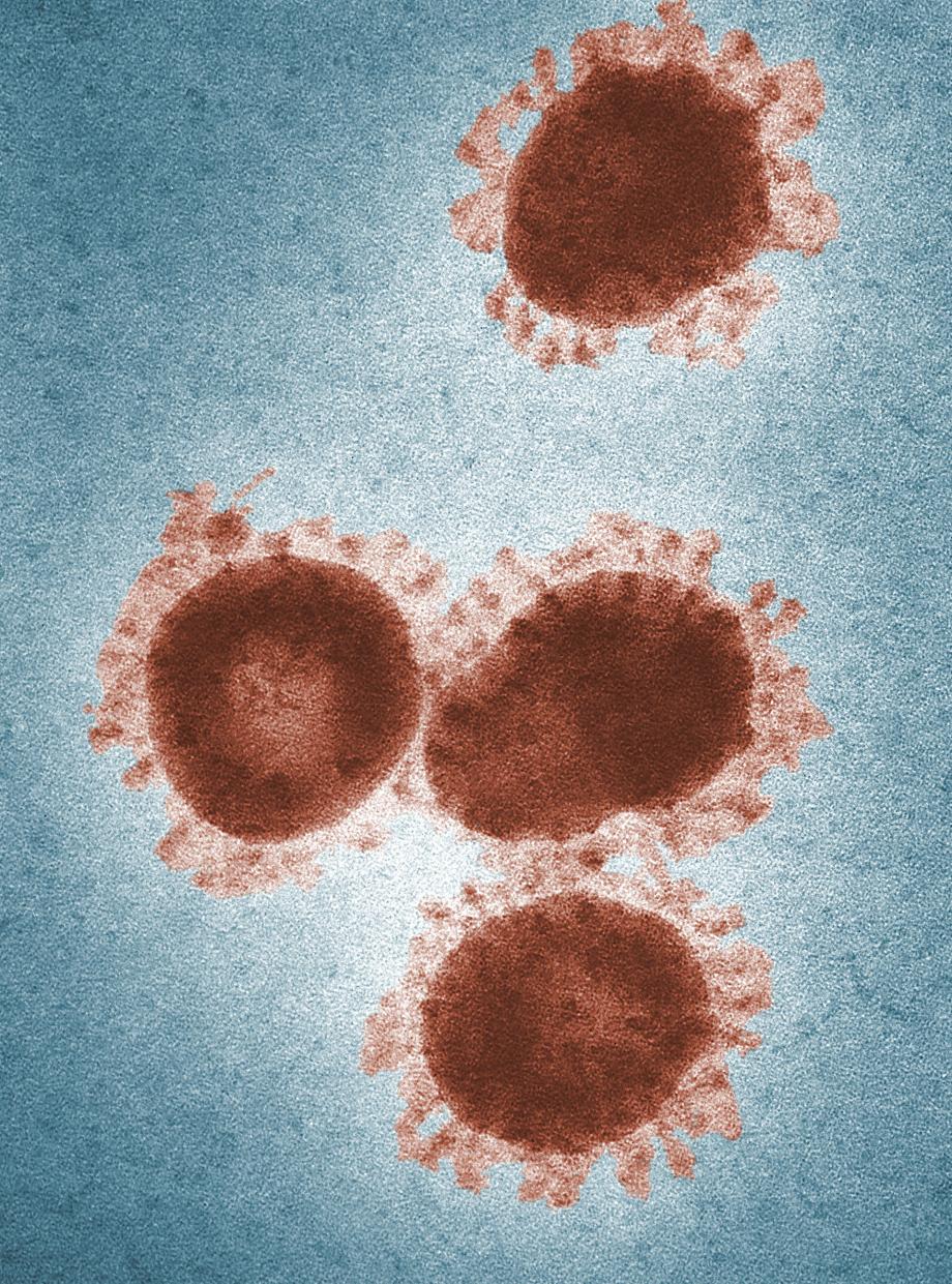 Selon ces experts, le COVID-19 pourrait être plus pathogène, provoquant une infection plus importante (Pexels)
