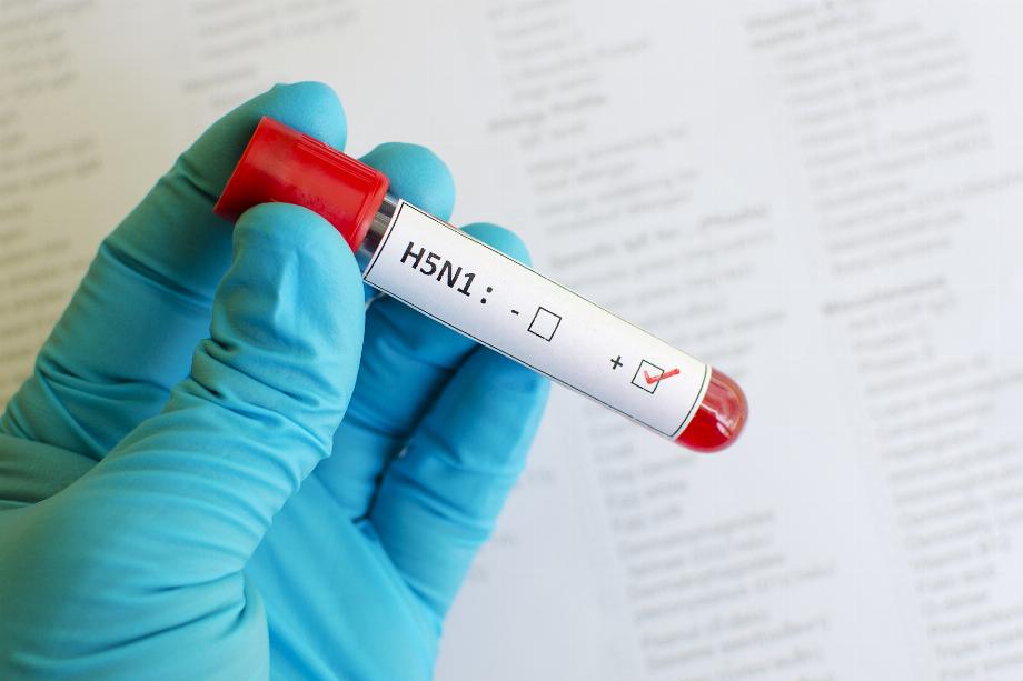 En 2009, le virus de la grippe A (H1N1) a subi des changements drastiques dans son génome et a infecté un grand nombre de personnes dans différents pays (Getty)
