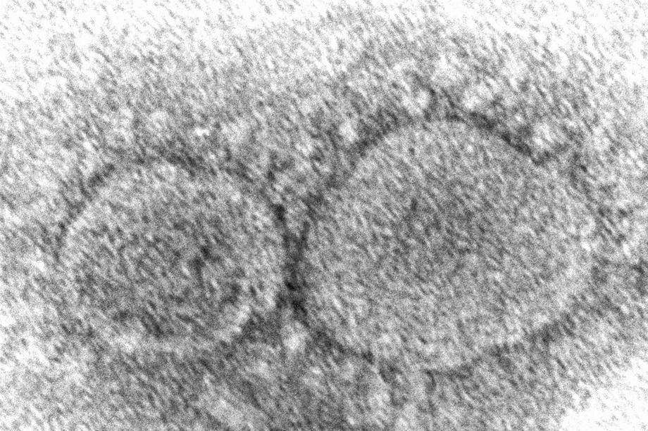 Cette image au microscope électronique publiée par les Centers for Disease Control and Prevention montre des particules du virus SARS-CoV-2, qui cause le COVID-19. (Hannah A. Bullock, Azaibi Tamin/CDC via AP, Fichier)