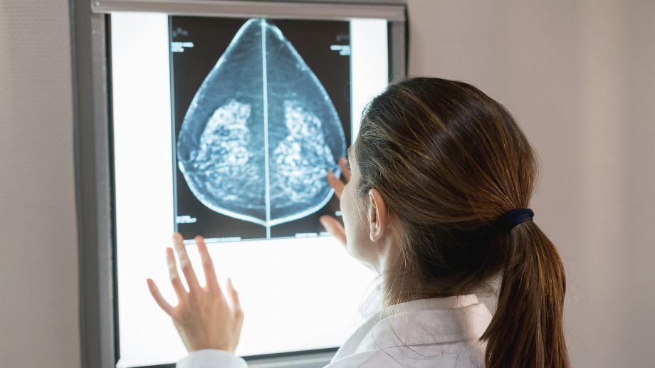 Aussi le ChatGPT, un chatbot d'intelligence artificielle, est utilisé pour le développement de traitements contre le cancer du sein (Getty Images)