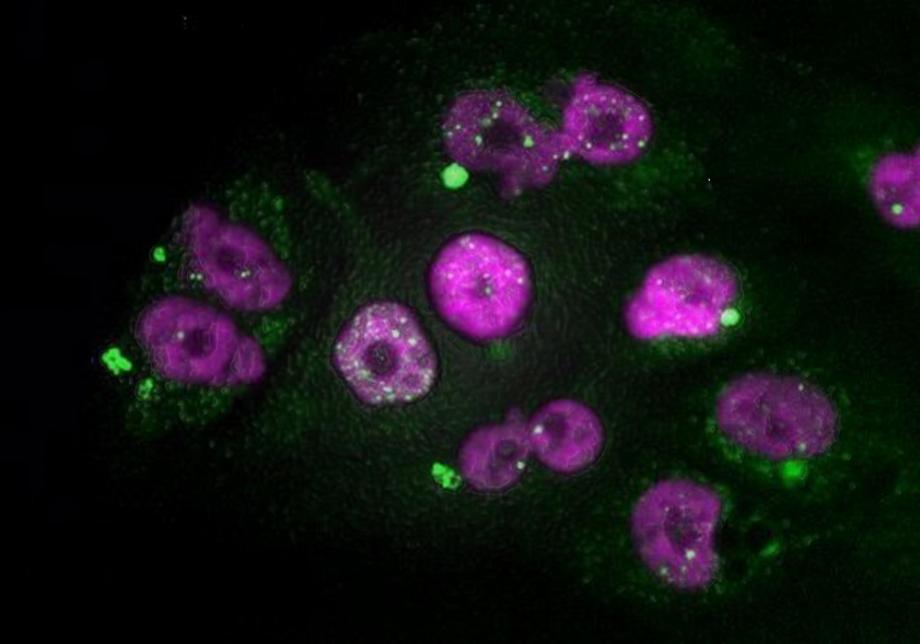 Cellules tumorales d'adénocarcinome pancréatique présentant des signes de dommages à l'ADN dans le noyau (points blancs) et les micronoyaux (en vert), après traitement au taxol suivi d'inhibiteurs de CDK4/6 (SALUD CNIO)