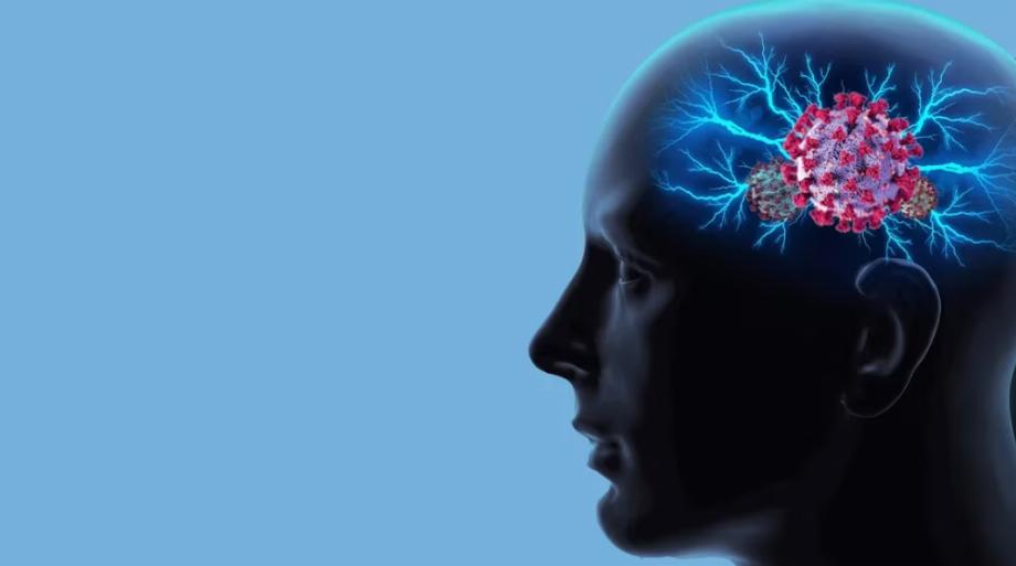 Les scientifiques ont découvert que le COVID-19 peut pénétrer dans le cerveau et causer des dommages neurologiques durables. Shutterstock