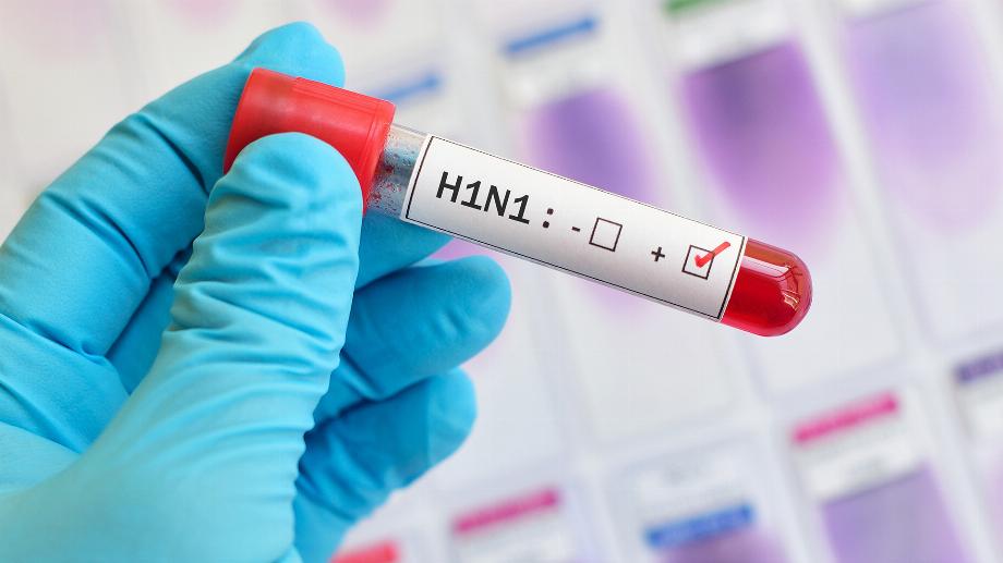 Photographie de référence. Virus H1N1 en Colombie. (Getty)