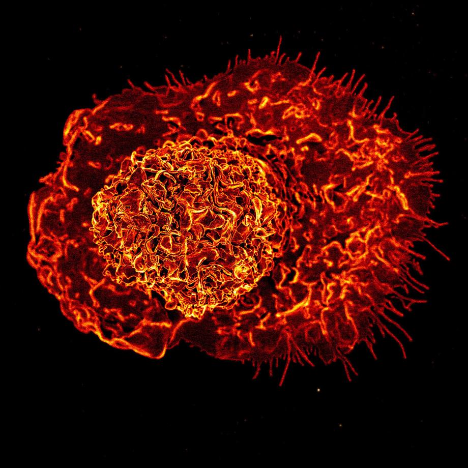 Micrographie électronique à balayage colorisée d'un macrophage, l'une des cellules immunitaires innées dérivées des monocytes : détails de l'étude (avec l'aimable autorisation de l'Institut national des allergies et des maladies infectieuses (NIAID))
