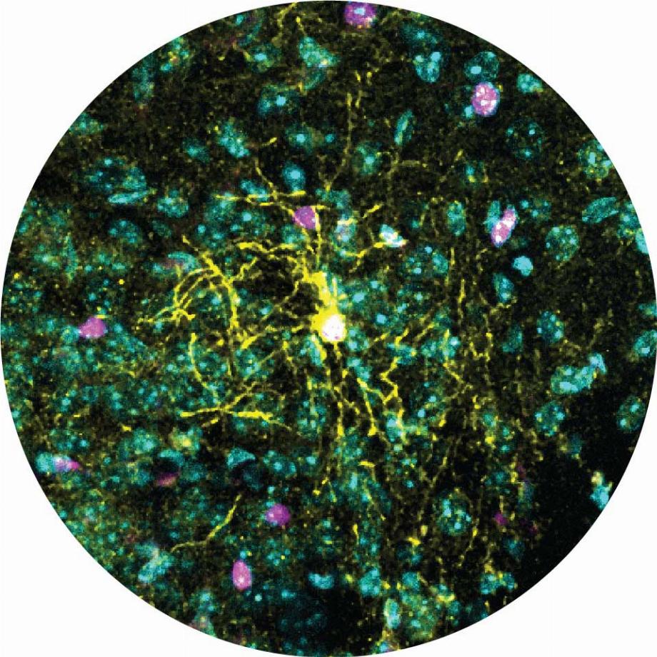 Une coupe du cerveau d'une souris au microscope. La couleur jaune montre la structure complexe d'un oligodendrocytes matures, avec de nombreuses branches atteignant les cellules environnantes. (Institut Weizmann)