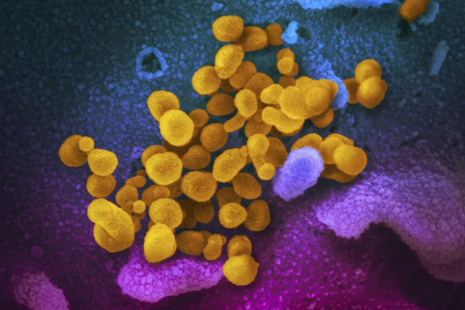 Cette image au microscope électronique distribuée par les National Institutes of Health des États-Unis en février 2020 montre le coronavirus SARS-CoV-2, indiqué en jaune, émergeant de la surface des cellules (bleu/rose). (NIAID-RML via AP, fichier)
